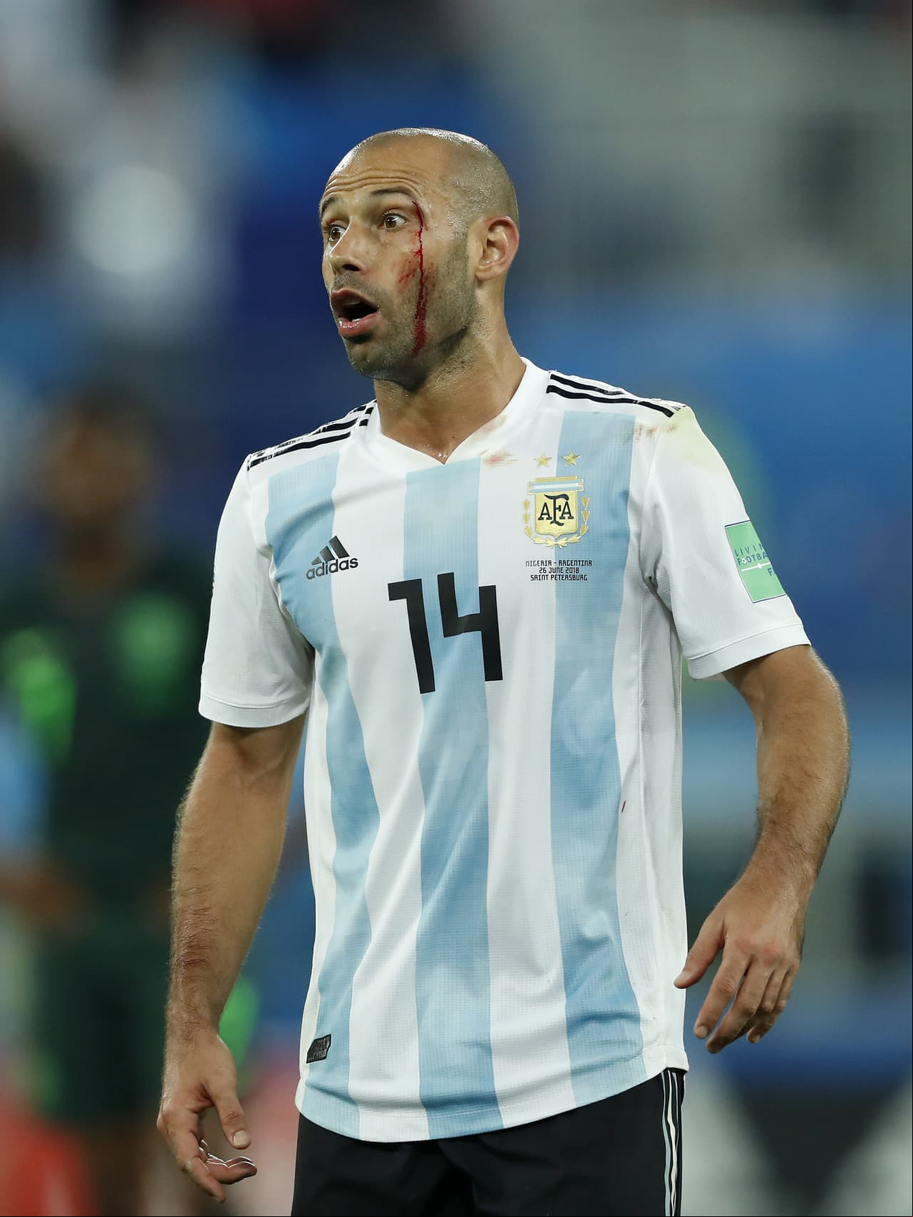 Blood in the face of Javier Mascherano of Argentina during the 2018 FIFA World Cup Russia group D match between Nigeria and Argentina at the Saint Petersburg Stadium on June 26, 2018 in Saint Petersburg, Russia(Photo by VI Images via Getty Images)